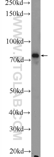 [17223-1-AP-20UL] Factor XIIIa Polyclonal antibody