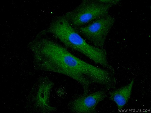 [17226-1-AP-20UL] USHBP1 Polyclonal antibody