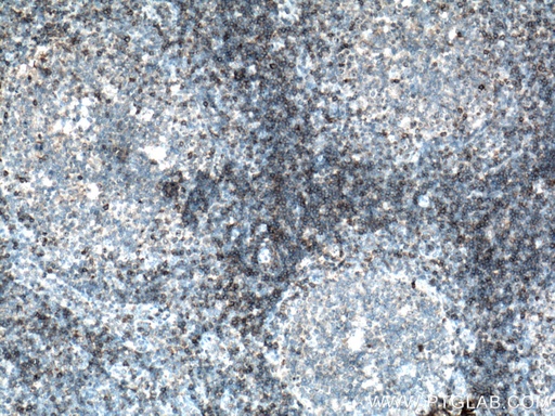[17227-1-AP-20UL] CD5 Polyclonal antibody