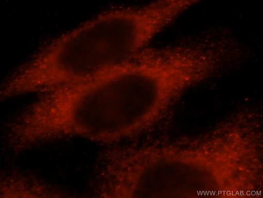[17229-1-AP-150UL] KLHL18 Polyclonal antibody