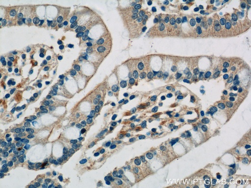 [17232-1-AP-150UL] TLR7 Polyclonal antibody
