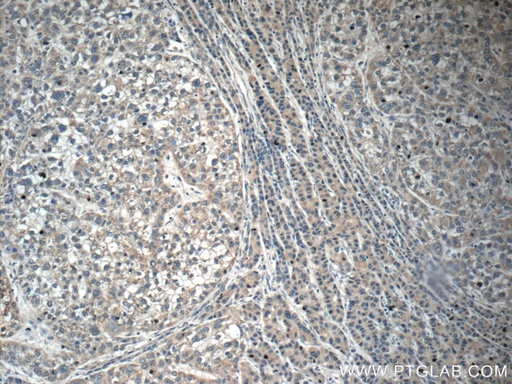 [17239-1-AP-150UL] C6 Polyclonal antibody