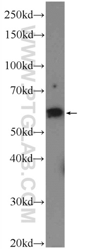 [17243-1-AP-20UL] CORO6 Polyclonal antibody