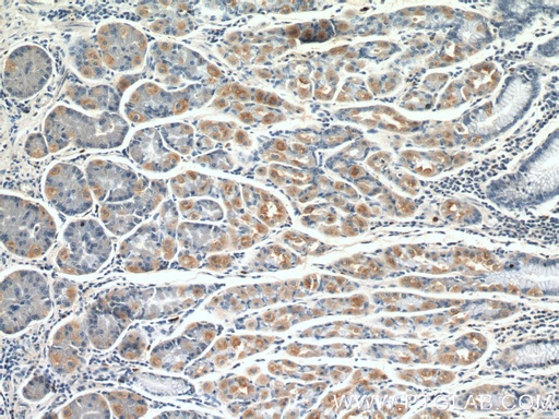[17246-1-AP-150UL] GDAP2 Polyclonal antibody