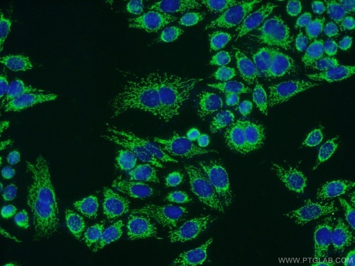 [17247-1-AP-150UL] ATPB Polyclonal antibody