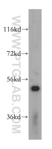[17248-1-AP-150UL] PUS3 Polyclonal antibody