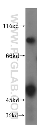 [17249-1-AP-150UL] ZNF611 Polyclonal antibody