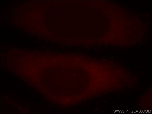 [17250-1-AP-150UL] RB1CC1 Polyclonal antibody