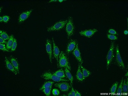 [17251-1-AP-20UL] Collagen Type VIII Polyclonal antibody