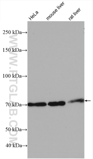 [17252-1-AP-150UL] TBC1D15 Polyclonal antibody