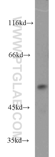 [17253-1-AP-150UL] DUS1L Polyclonal antibody
