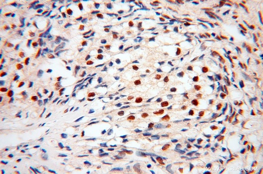 [17254-1-AP-20UL] BBX Polyclonal antibody