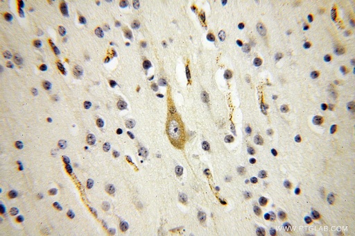 [17256-1-AP-20UL] SQRDL Polyclonal antibody