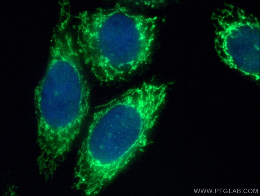 [17258-1-AP-150UL] SARS2 Polyclonal antibody