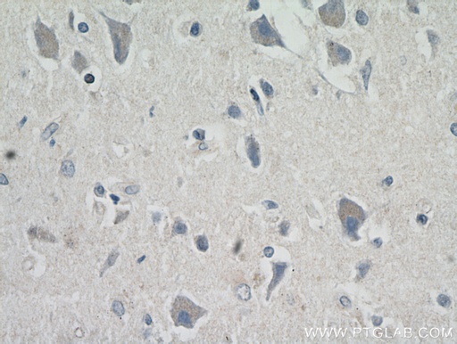 [17259-1-AP-20UL] MRAP2 Polyclonal antibody
