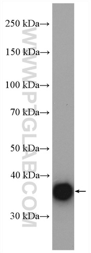 [17263-1-AP-20UL] GPD1L Polyclonal antibody