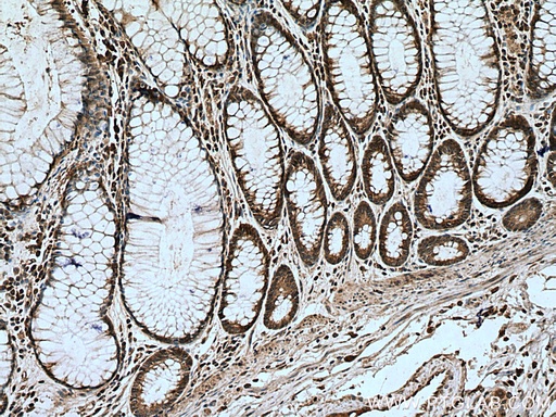 [17267-1-AP-20UL] RUNDC1 Polyclonal antibody