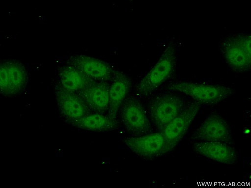 [17270-1-AP-20UL] POLR2I Polyclonal antibody