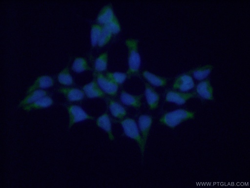 [17271-1-AP-150UL] GSTA4 Polyclonal antibody