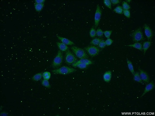 [17272-1-AP-150UL] SNAPC5 Polyclonal antibody