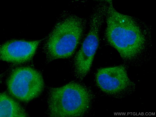 [17275-1-AP-150UL] CALML3 Polyclonal antibody
