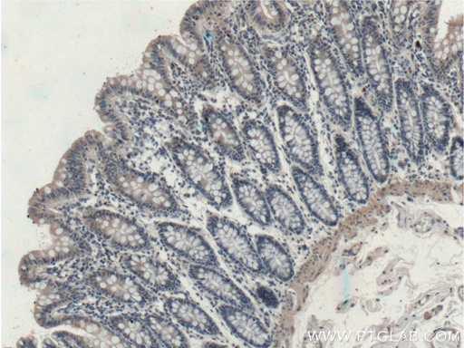 [17276-1-AP-150UL] EFCAB1 Polyclonal antibody
