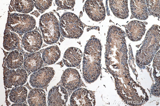 [17277-1-AP-150UL] LARP2 Polyclonal antibody