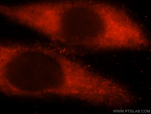 [17278-1-AP-150UL] UBE2L6 Polyclonal antibody