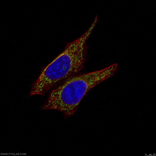 [17280-1-AP-150UL] MRPS27 Polyclonal antibody