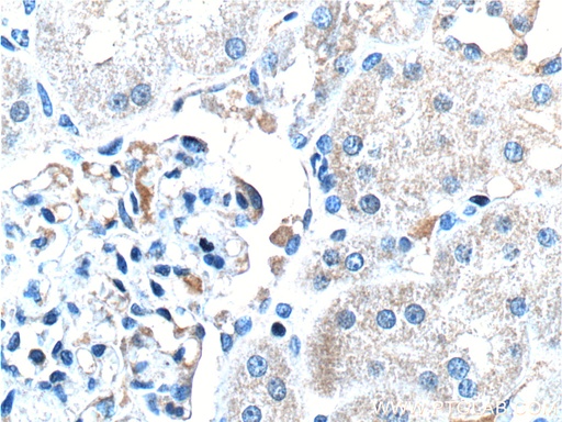 [17281-1-AP-20UL] MT1M Polyclonal antibody