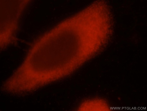 [17282-1-AP-20UL] EIF4E3 Polyclonal antibody