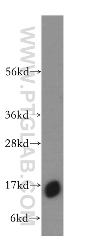 [17284-1-AP-150UL] HBZ Polyclonal antibody