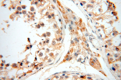 [17287-1-AP-150UL] UBE2DNL Polyclonal antibody