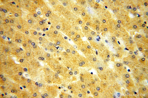 [17290-1-AP-150UL] KIF6 Polyclonal antibody