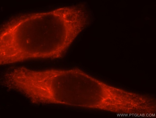 [17293-1-AP-20UL] GIMAP7 Polyclonal antibody