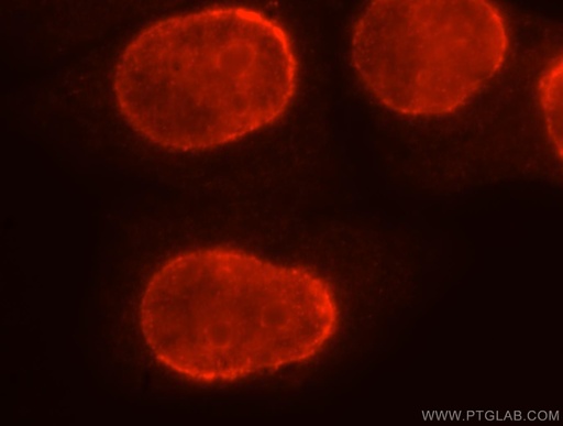 [17295-1-AP-150UL] BXDC2 Polyclonal antibody