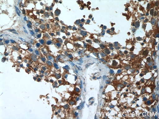 [17299-1-AP-150UL] AGA Polyclonal antibody