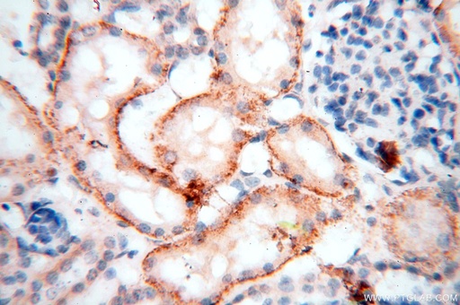 [17301-1-AP-150UL] HSD17B11 Polyclonal antibody