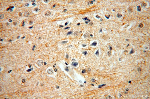 [17305-1-AP-150UL] ENPP4 Polyclonal antibody