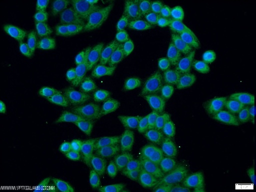 [17311-1-AP-20UL] ERLIN1 Polyclonal antibody