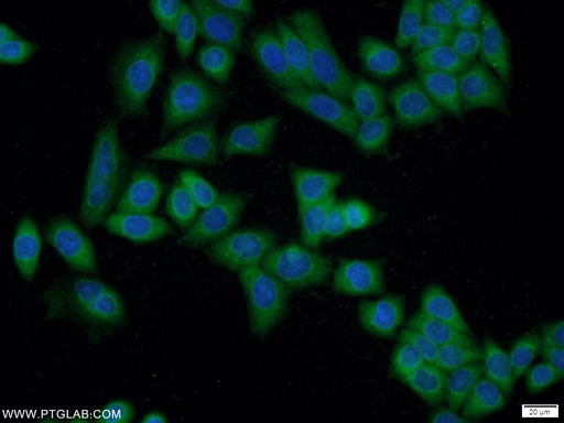 [17313-1-AP-20UL] EXD1 Polyclonal antibody