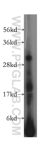 [17315-1-AP-150UL] HLA-DQB2 Polyclonal antibody