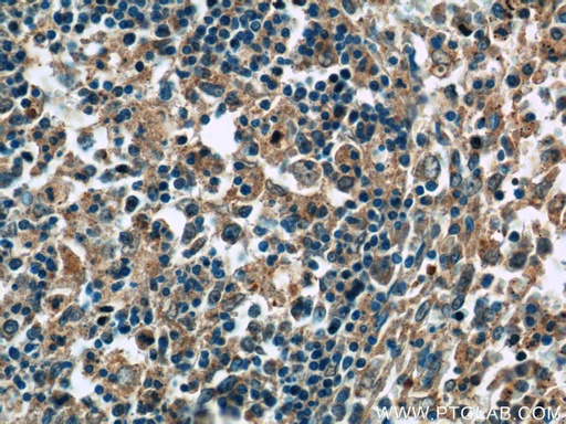 [17321-1-AP-20UL] ERMP1 Polyclonal antibody
