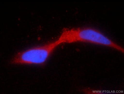 [17322-1-AP-150UL] TRPV5 Polyclonal antibody