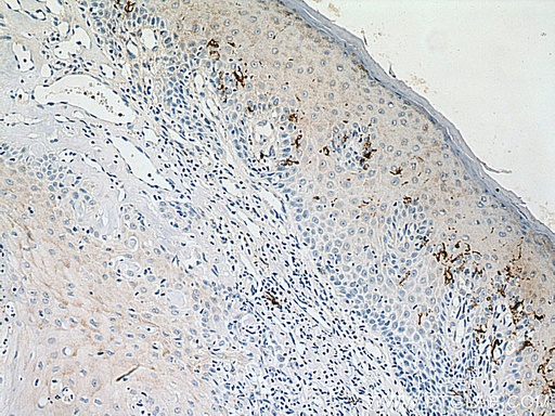 [17325-1-AP-150UL] CD1a Polyclonal antibody