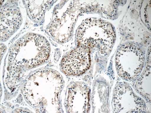 [17326-1-AP-150UL] TSGA13 Polyclonal antibody