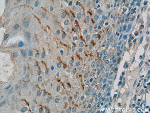 [17328-1-AP-20UL] GSG1L Polyclonal antibody