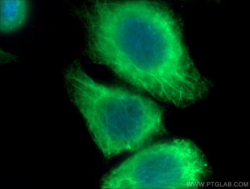 [17329-1-AP-20UL] Cytokeratin 20 Polyclonal antibody