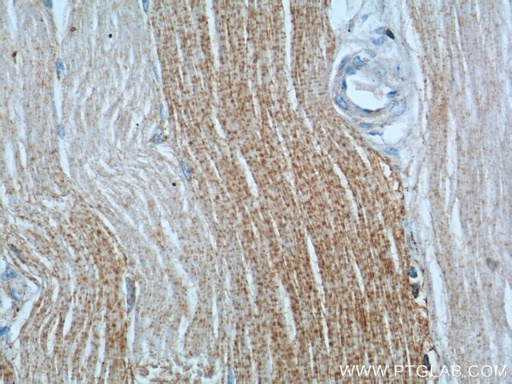 [17331-1-AP-150UL] DNAJC11 Polyclonal antibody