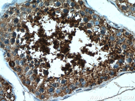 [17333-1-AP-150UL] LIPE Polyclonal antibody